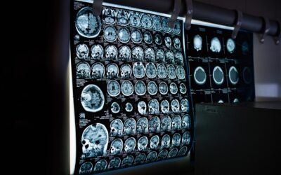 Keunggulan Teknologi Retina Scanner Dibandingkan Metode Biometrik Lain
