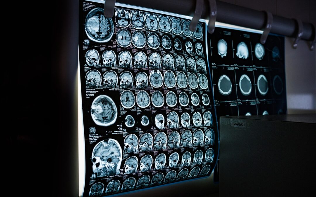 Retina Scanner vs Face Recognition: Mana Yang Lebih Andal?